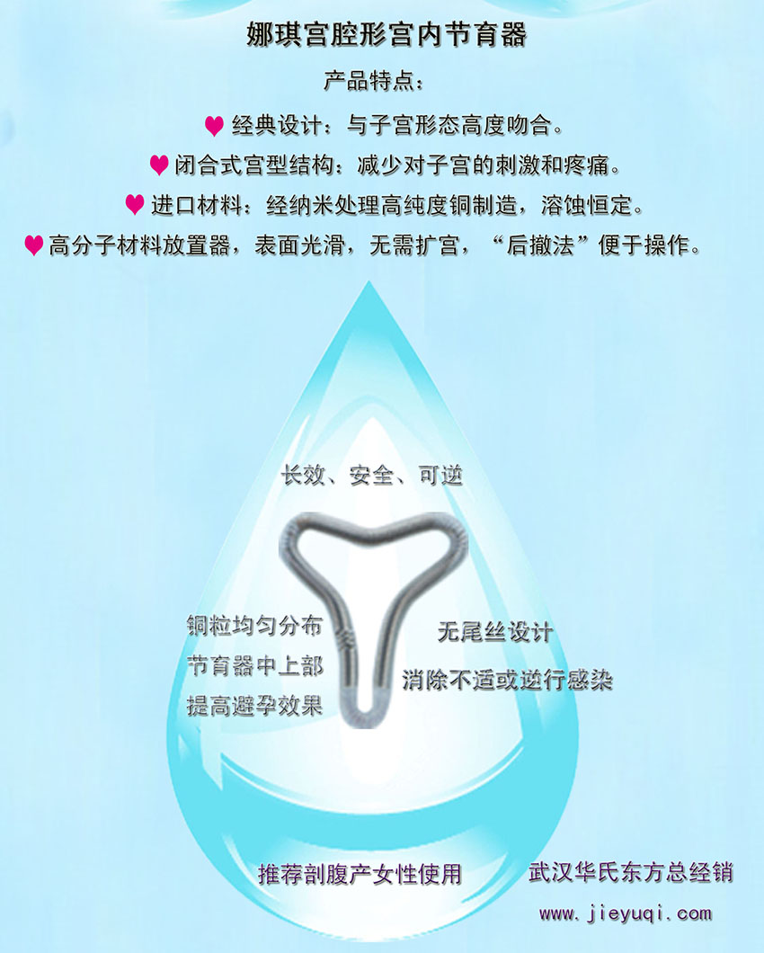 宫腔形节育器娜琪